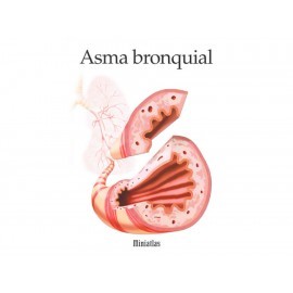 Asma Bronquial