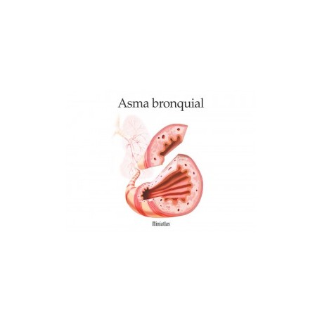 Asma Bronquial